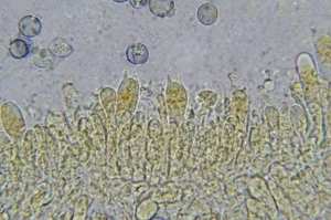 Gills + ring + volva — white free gills; skirt-like ring; egg stage (volva) emerging at right